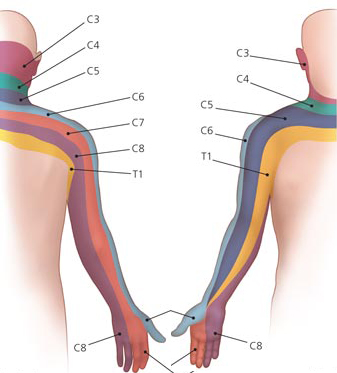 Effective Solutions for Radiating Pain in Arms