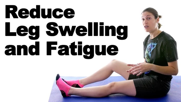 Best Products to Reduce Leg Swelling Fast